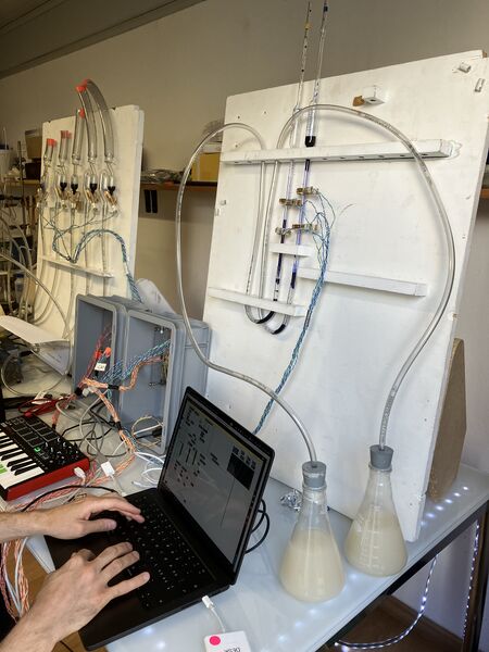 File:Yeast Organ .jpg